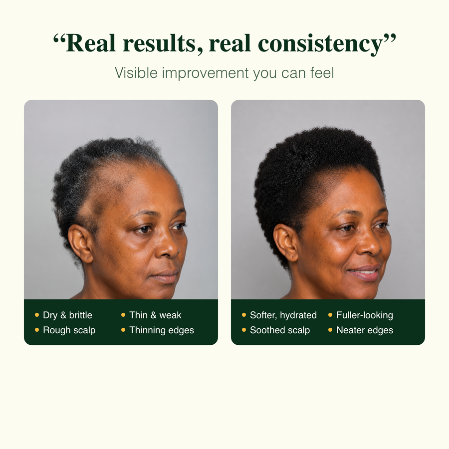 Real results: softer, fuller-looking, soothed scalp, neater edges