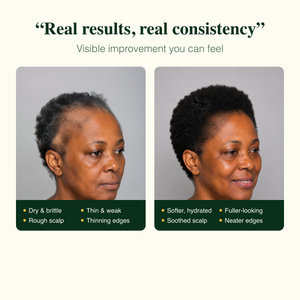 Real results: softer, fuller-looking, soothed scalp, neater edges