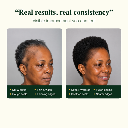 Real results: softer, fuller-looking, soothed scalp, neater edges
